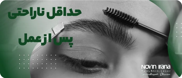 بهترین روش برای کاشت ابرو